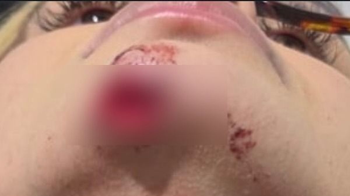 Influencer relata ter sido agredida por ex em bairro da parte alta