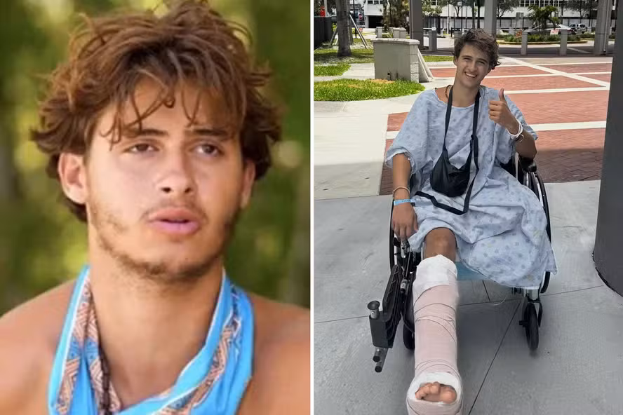 Ex-participante de reality pede R$ 510 milhões após perder perna em acidente