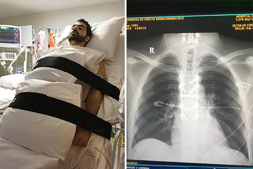 Cientista da UFRJ cria proteína que pode recuperar movimentos após lesão na medula