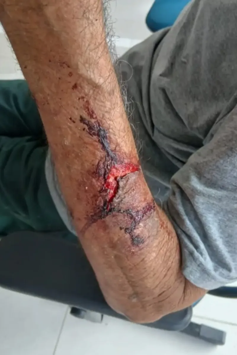 Mulher é presa suspeita por roubo e agressão de idoso em Alagoas