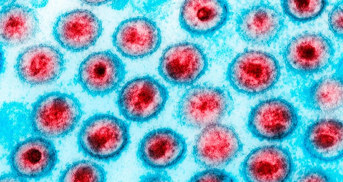 Dois novos casos de possível cura do HIV são revelados em conferência