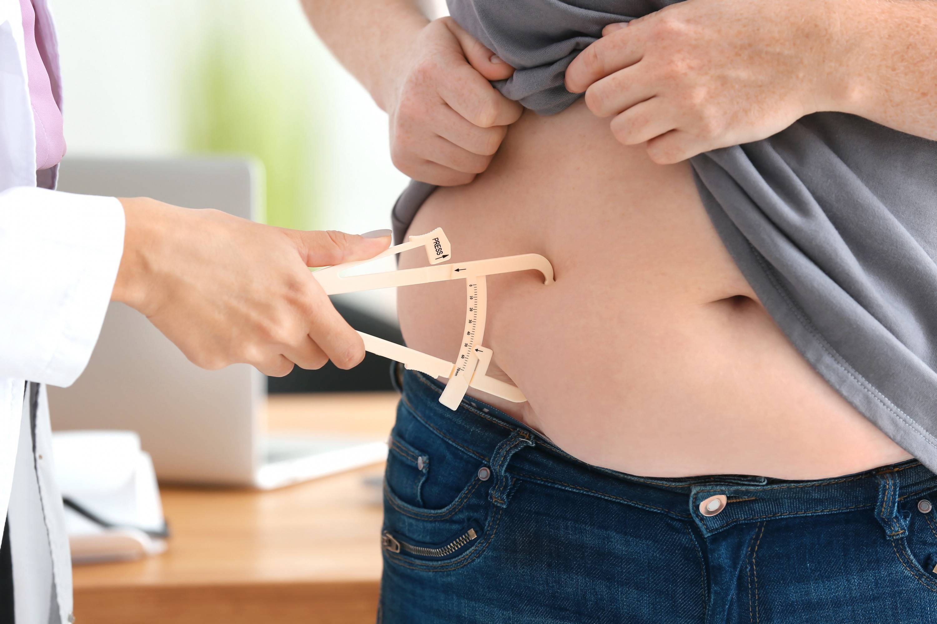 Unimed deve custear cirurgia plástica reparadora de mulher que fez bariátrica