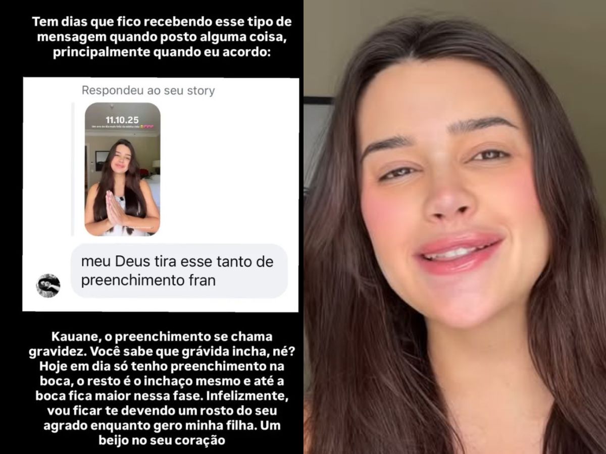 Franciny Ehlke rebate crítica sobre preenchimento: “Se chama gravidez”
