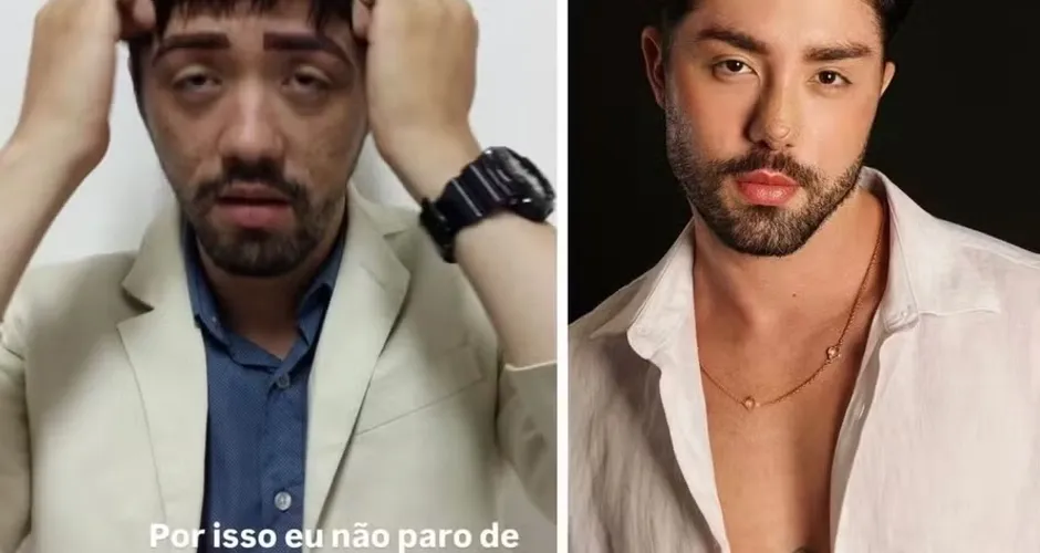 Rico Melquíades surpreende com fotos de antes e depois de cirurgias