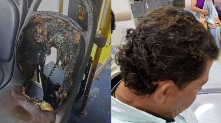 Criminosos ateiam fogo em ônibus e motorista fica ferido
