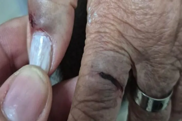 MP denuncia médica por agredir tia idosa com ajuda da filha em Arapiraca