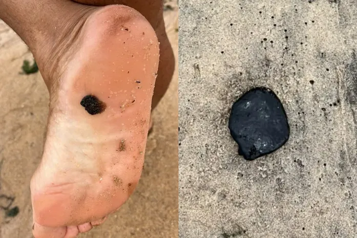 Manchas de óleo voltam a aparecer nas praias de Maceió