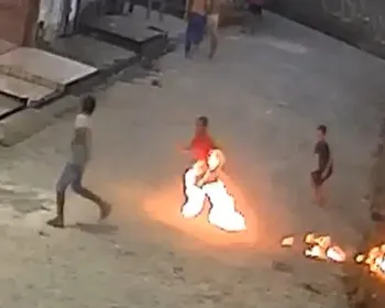 'Pedindo forças a Deus': Mãe de menino ferido por fogos em AL relata desespero
