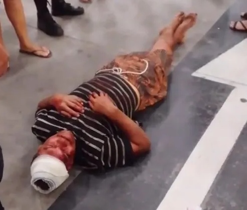 Violência em supermercado termina com cliente em estado grave na parte alta de Maceió