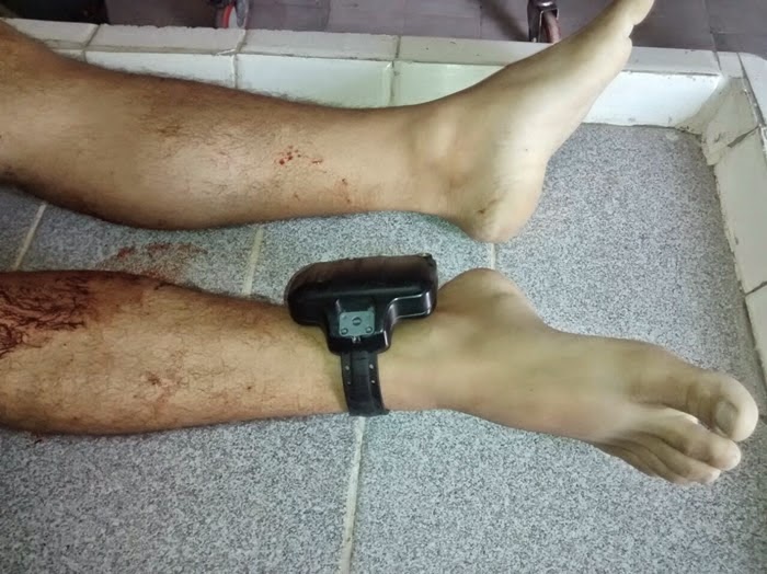 Homem de 28 anos é morto a pauladas após briga com vizinho, na Cidade Universitária