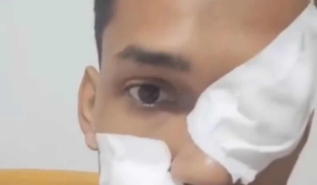 Motorista é baleado no rosto durante emboscada em rodovia de Alagoas