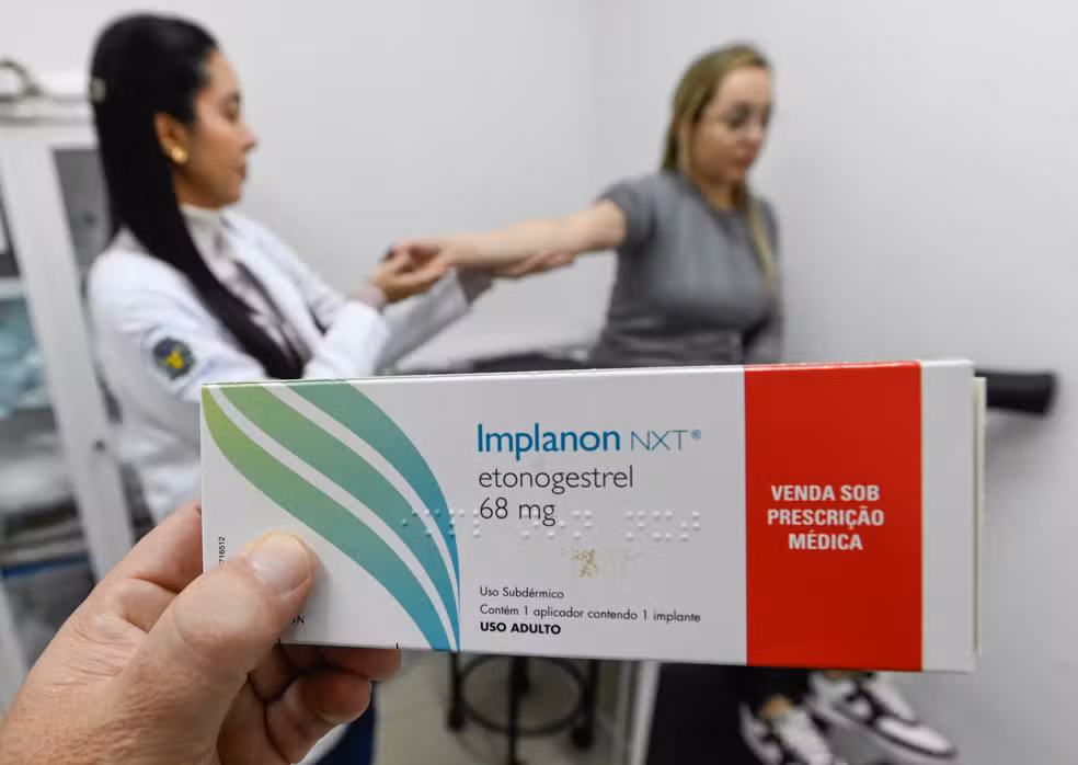 Implante contraceptivo de R$4 mil deve ser ofertado por planos a partir de hoje