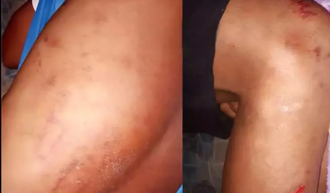 Família pede Justiça após jovem ser agredido por Guarda Municipal em São José da Laje