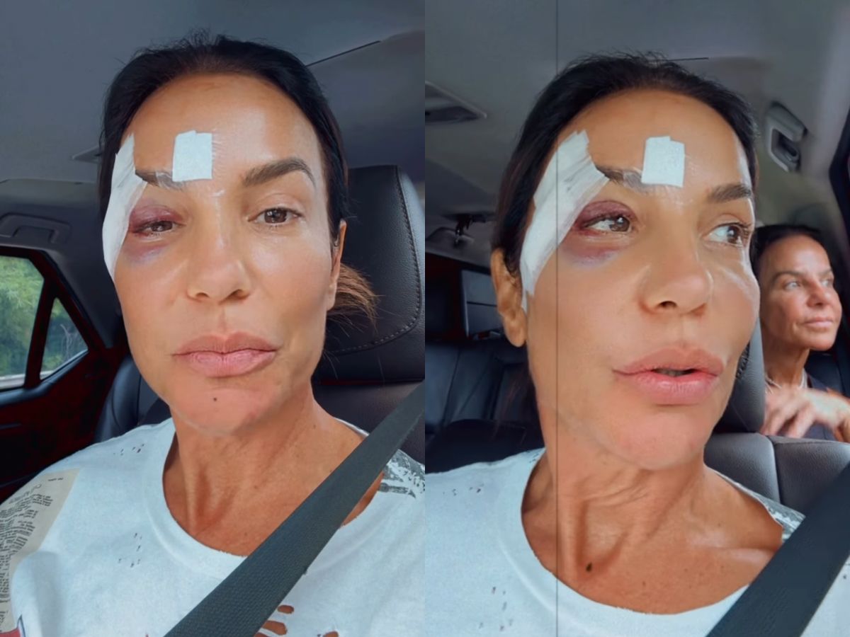 Após susto, Ivete Sangalo tranquiliza fãs e explica diagnóstico