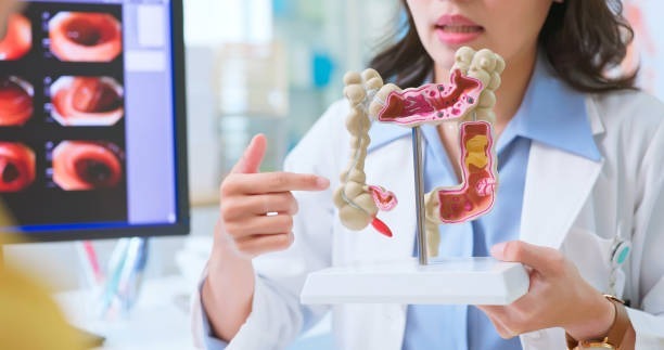 Câncer colorretal: informação e prevenção são aliados no diagnóstico precoce