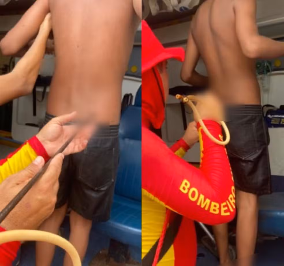 Adolescente é atingido por arpão durante pesca subaquática na Praia do Francês