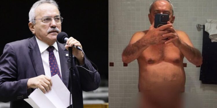 Ex-deputado de 79 anos publica nudes nas redes sociais
