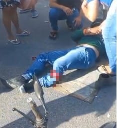 Motociclista sofre fratura exposta após colisão com caminhão em Rio Largo